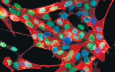 Mikroskopowy obraz komórek wyhodowanych przez niemiecki zespół. Kolorowe znaczniki pomagają w identy
