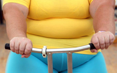 W wypadku znacznej otyłości ćwiczenia najlepiej prowadzić pod okiem terapeuty