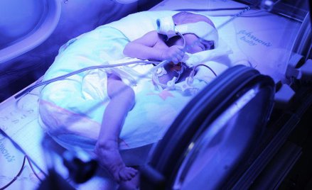 Według informacji przekazanych Ordo Iuris dziecko, które przeżyło aborcję miało przebywać w inkubato