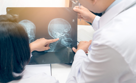 W leczeniu nowotworów głowy i szyi lekarze coraz częściej sięgają po immunoterapię. W chirurgii wyko