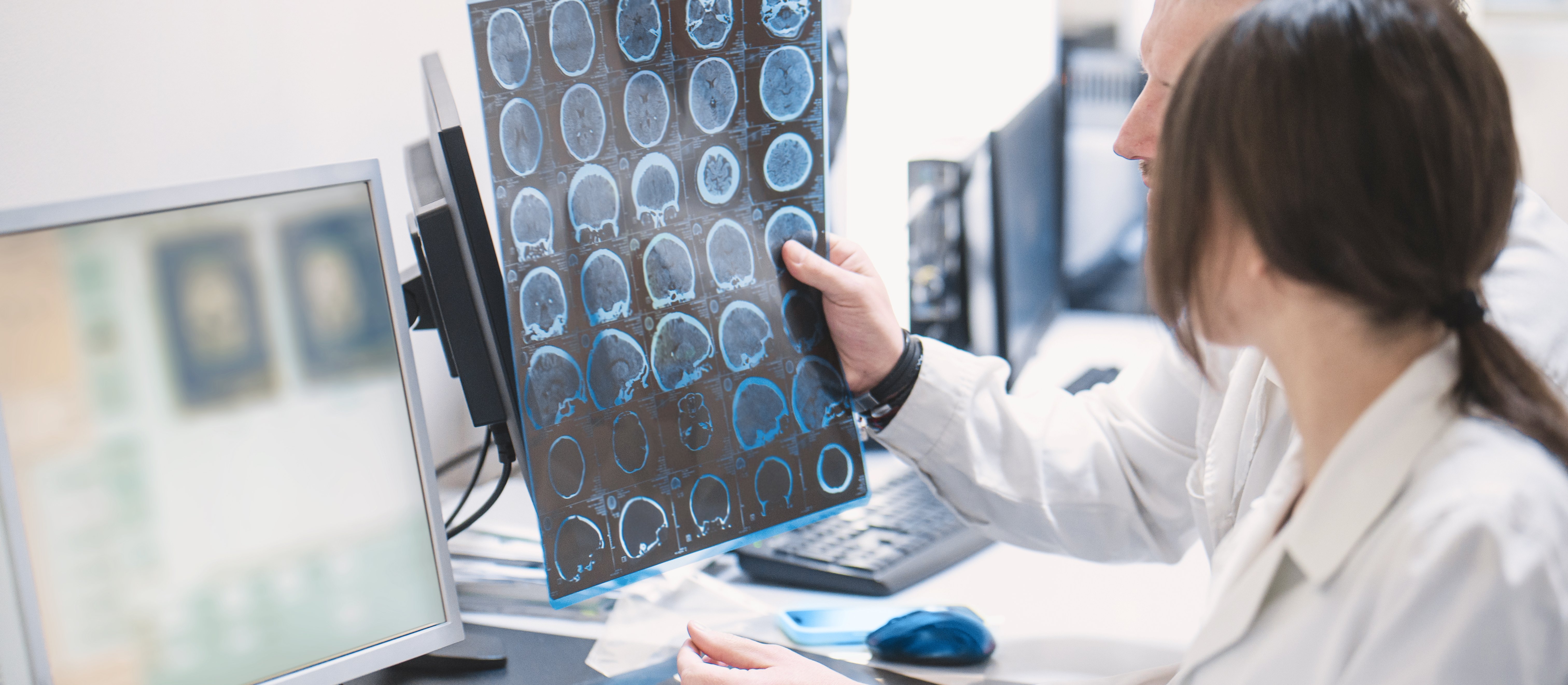 AI pomoże wykryć chorobę Alzheimera. Nowe narzędzie badaczy z USA