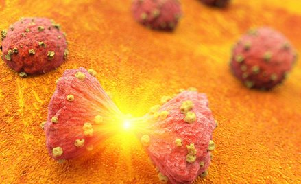 W leczeniu szpiczaka plazmocytowego zwiększamy dystans dzielący nas od Europy Zachodniej