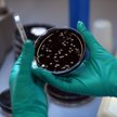 Legionella wykryta w warszawskim przedszkolu. Placówka nie została zamknięta