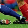 Po tym ataku Martina Taylora (Birmingham, niebieskie getry) Eduardo da Silva (Arsenal) leczył się pr