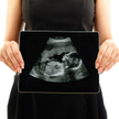 Lista 26 klinik, które wezmą udział w rządowym programie in vitro, od 18 czerwca dostępna jest na st
