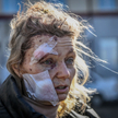 Ukrainka ranna w jednym z rosyjskich ataków