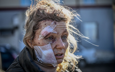 Ukrainka ranna w jednym z rosyjskich ataków