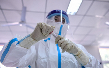 Rosyjski ekspert: Koronawirus jest pochodzenia naturalnego, ale mógł "uciec" z laboratorium