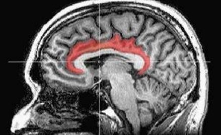 Ten region mózgu jest mniej aktywny u recydywistów