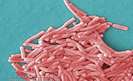 USA: Nowe zagrożenie w związku z COVID - legionelioza