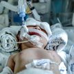 Program „Za życiem" miał wspierać kobiety, które zdecydowały się na urodzenie ciężko chorego dziecka