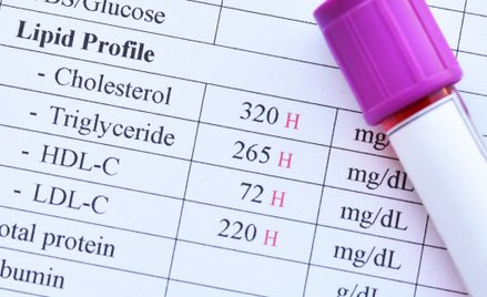 Cholesterol ma dwie frakcje – tzw. złą LDL (od ang. „low density lipoprotein”) i tzw. dobrą - HDL (a
