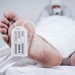 Sekcje zwłok po szczepieniu potrzebne, ale niemożliwe