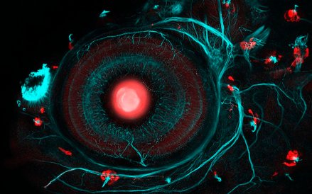 Fot: Ingrid Lekk i Steve Wilson. Zdjęcie pokazuje 4-dniowy, zmodyfikowany zarodek słodkowodnej ryby 