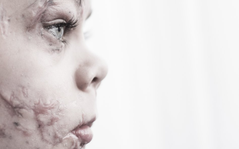 Człowiek (zdjęcie pojedyncze): 1. miejsce - Mateusz Baj, InPro