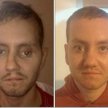 Stephen Power przed i po operacji rekonstrukcji lewej części twarzy / Abertawe Bro Morgannwg Univers