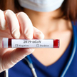 Opracowano pierwszy test, który zmierzy odporność na koronawirusa