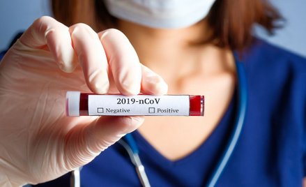 Opracowano pierwszy test, który zmierzy odporność na koronawirusa
