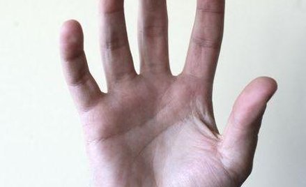 Sztuczna dłoń lepsza niż własna