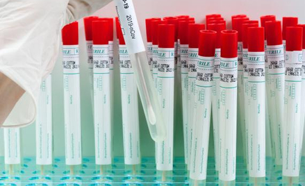 BioMaxima przygotowana na kolejną falę pandemii