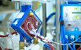 Wynalazek naukowców ze śląską może zastąpić ECMO