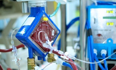 Wynalazek naukowców ze śląską może zastąpić ECMO