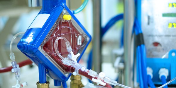 Polski wynalazek może być nowym ECMO. Już otrzymał amerykański patent