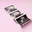 Aborcja selektywna budzi wątpliwości nawet środowisk pro-choice