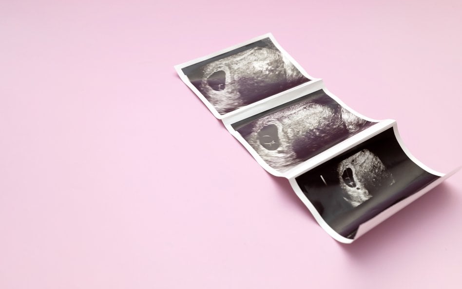 Aborcja selektywna budzi wątpliwości nawet środowisk pro-choice
