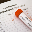 Prawnicy: wykonywanie zobowiązań umownych w czasach pandemii koronawirusa