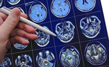 Ryvu z 22 mln zł dofinansowania