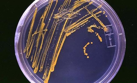 Atakowani przez drobnoustroje z piekła rodem