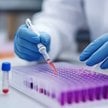 Biotechnologia w blokach startowych. 12 niedowartościowanych spółek