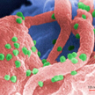 Tak wygląda pod mikroskopem limfocyt zaatakowane przez wirusy HIV