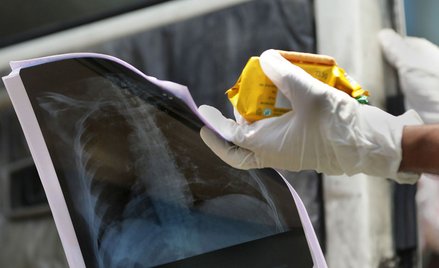 Pierwszy śmiertelny przypadek COVID-19 w Laosie