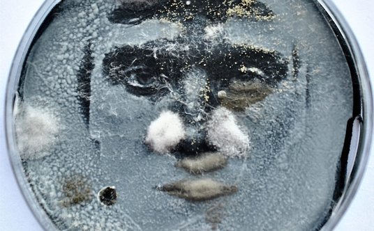 Saccharomyces cerevisiae  na podłożu Sabourauda z węglem aktywnym, 60x40