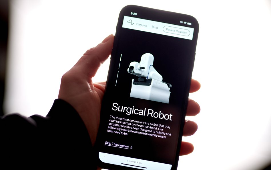 System Blindsight firmy Neuralink nie próbuje naprawiać uszkodzonego narządu wzroku, a zamiast tego 