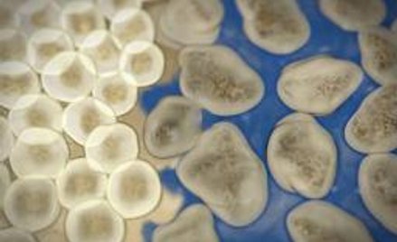 Małym magnesem w raka