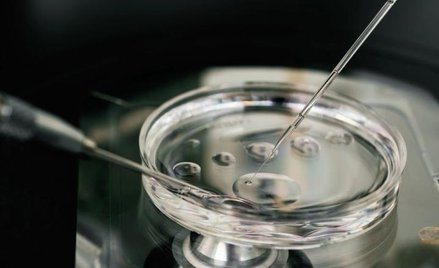 Techniki wspomagania rozrodu łączące komórki trzech osób to „in vitro nowej generacji”