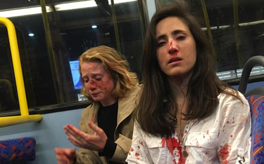 Londyn: Para lesbijek pobita w autobusie. Nastolatkowie przed sądem