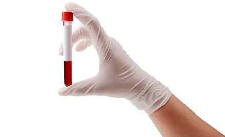 Testy na schizofrenię ciągle są w fazie eksperymentalnej