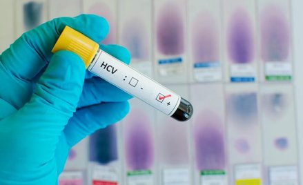 Wirusowe zapalenie wątroby stanie się wkrótce problemem nie tylko zdrowotnym ale i ekonomicznym