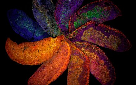 Fot: Suchita Nadkarni. Zdjęcie pokazuje różnice w rozwoju łożyska myszy.