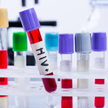 Londyn: Drugi na świecie przypadek wyleczenia HIV?
