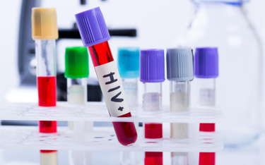 Wirus HIV na wokandzie: jak duże jest ryzyko zakażenia