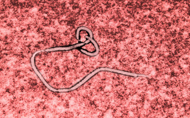 Wirus Eboli pod mikroskopem