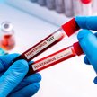 Czworo Polaków pod nadzorem epidemiologicznym GIS. Mogli mieć kontakt z hantawirusem