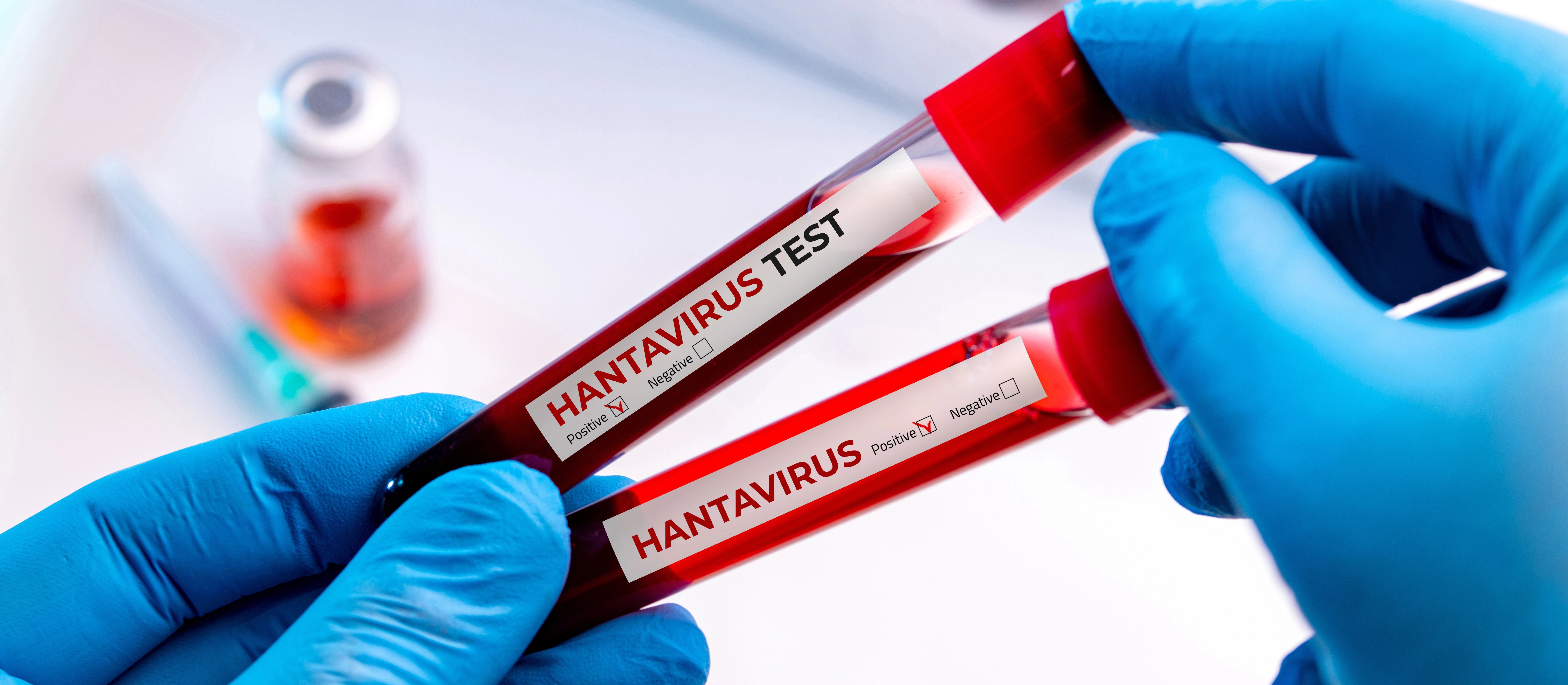 Czworo Polaków mogło mieć kontakt z hantawirusem. Są pod nadzorem epidemiologicznym