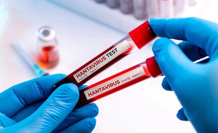 Czworo Polaków pod nadzorem epidemiologicznym GIS. Mogli mieć kontakt z hantawirusem