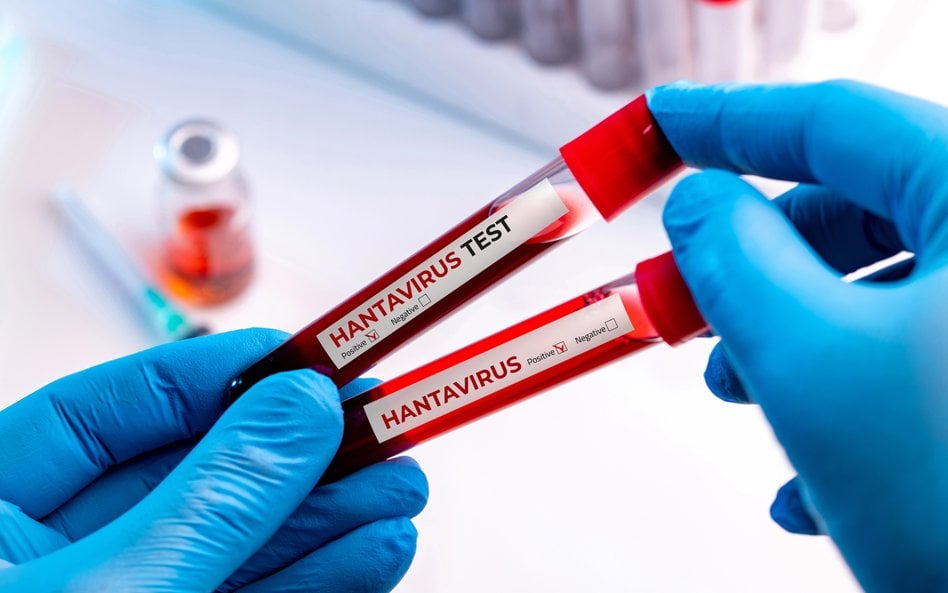 Czworo Polaków pod nadzorem epidemiologicznym GIS. Mogli mieć kontakt z hantawirusem